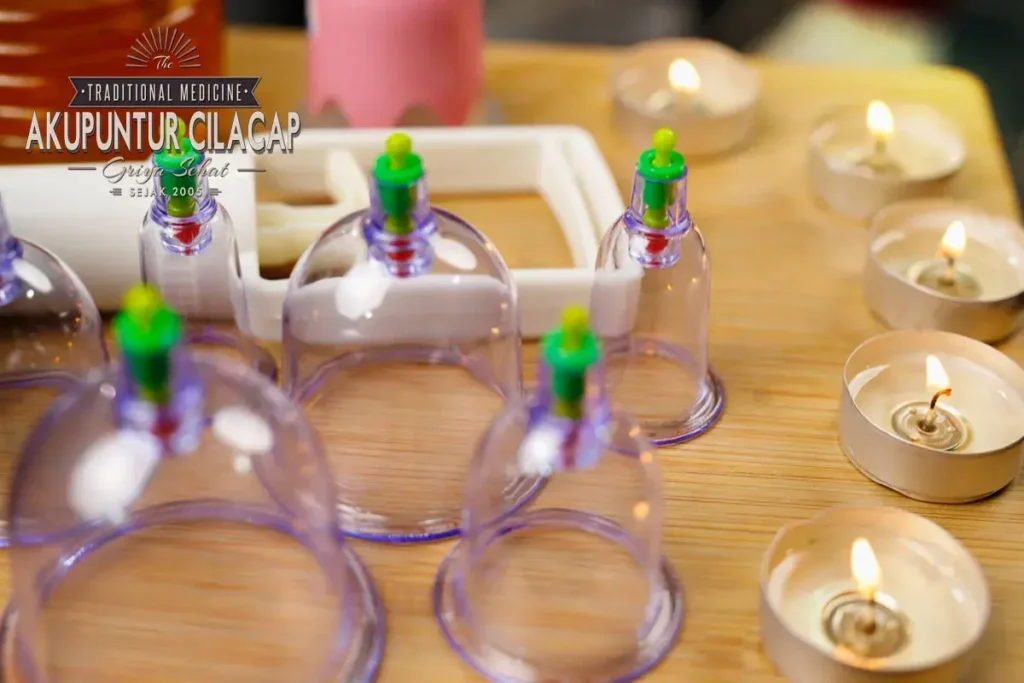 Griya Terapi Bekam Cilacap