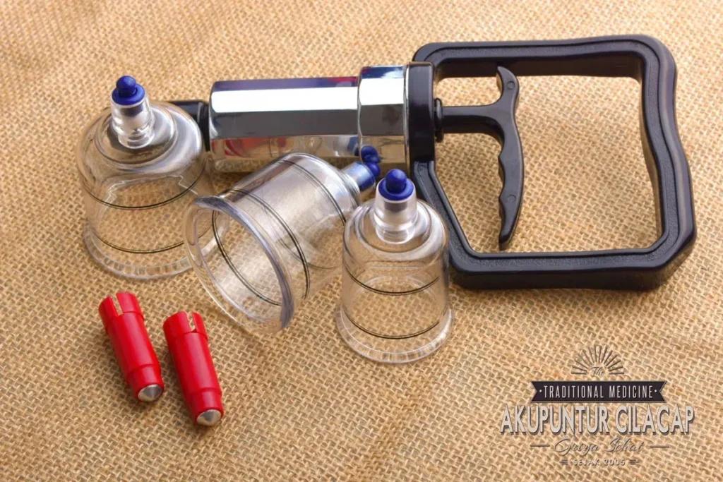 Keunggulan Griya Bekam Cilacap