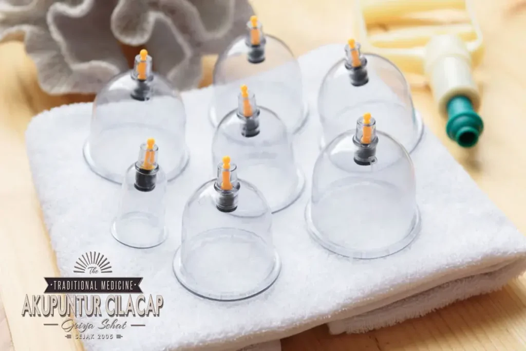 Layanan Tambahan di Griya Bekam Cilacap