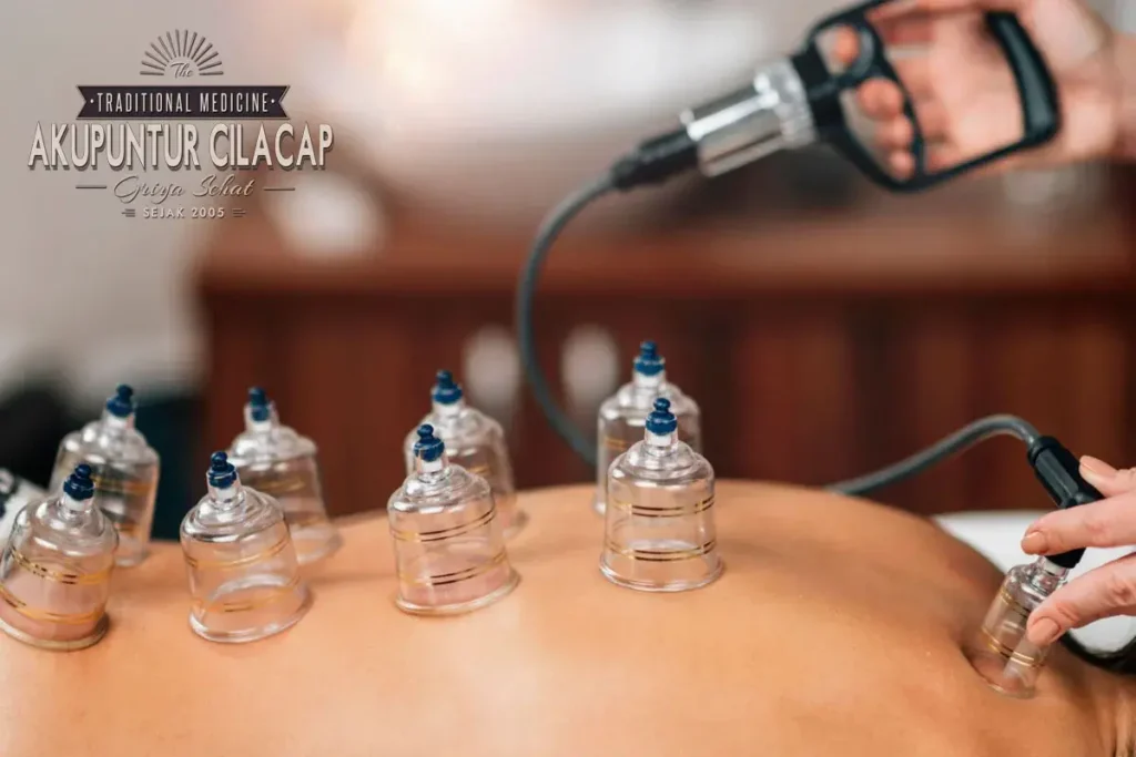 Mengapa Memilih Griya Bekam Cilacap