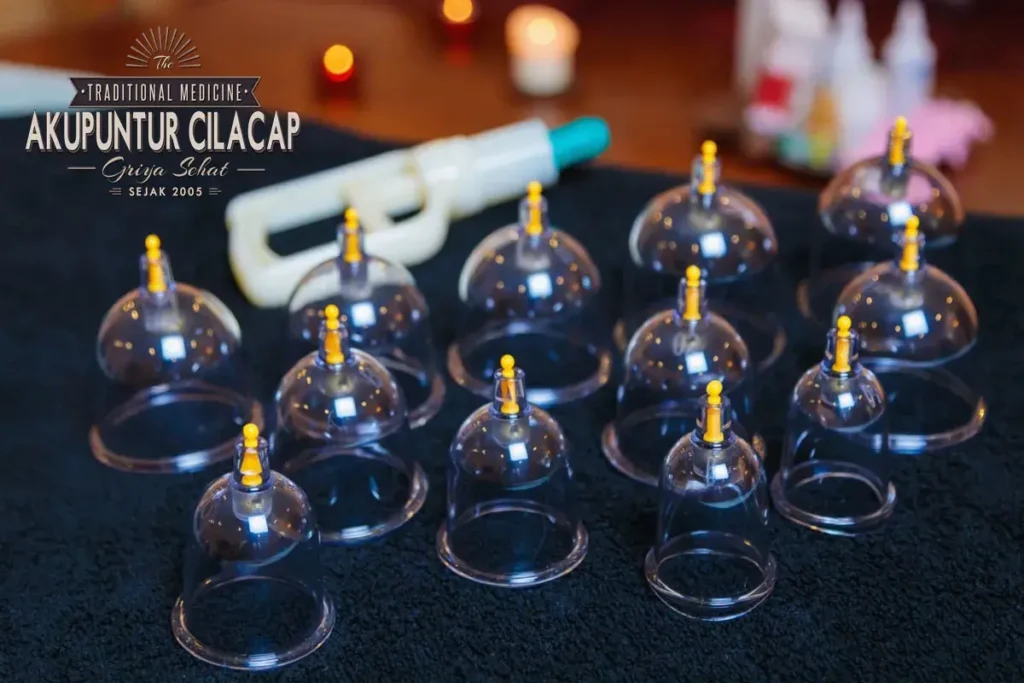 Peralatan yang Dibutuhkan untuk Terapi Bekam