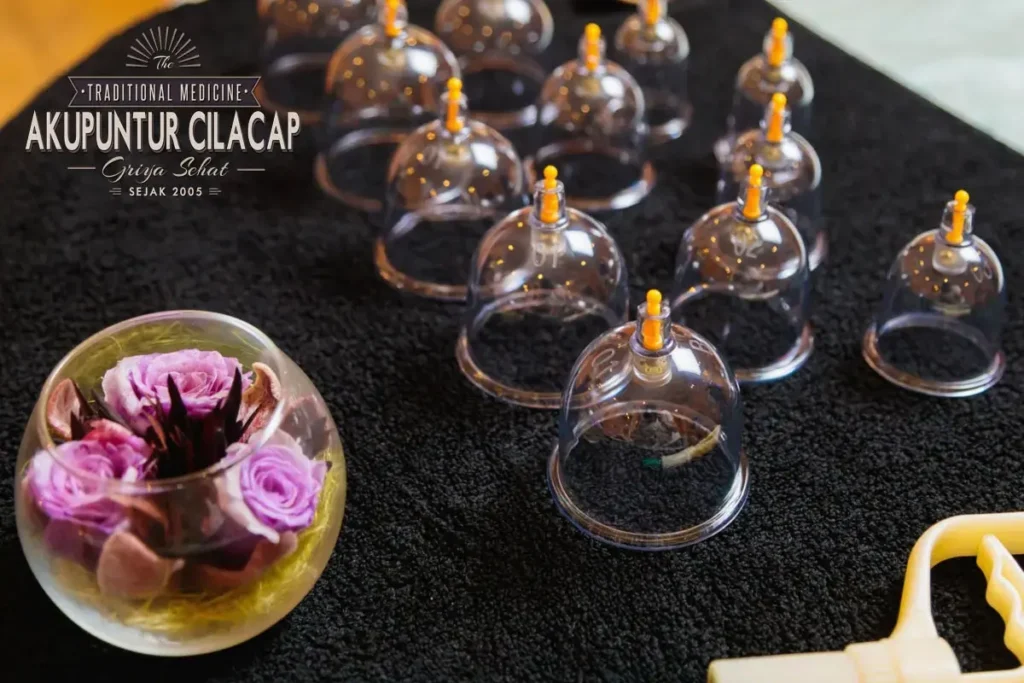 Proses Pengobatan Bekam di Griya Bekam Cilacap